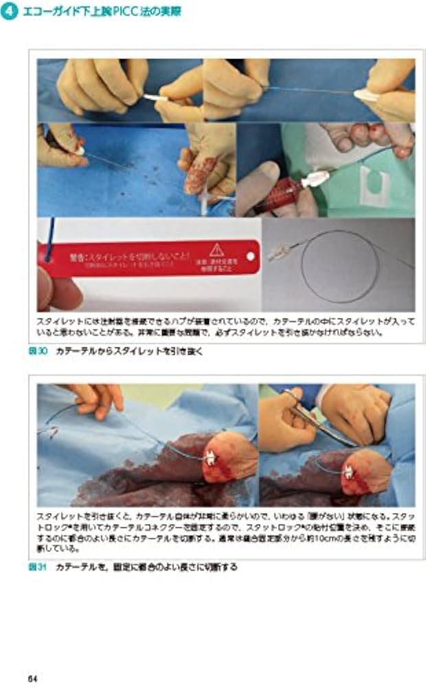 PICC 末梢挿入式中心静脈カテーテル管理の理論と実際 | 井上 善文 |本